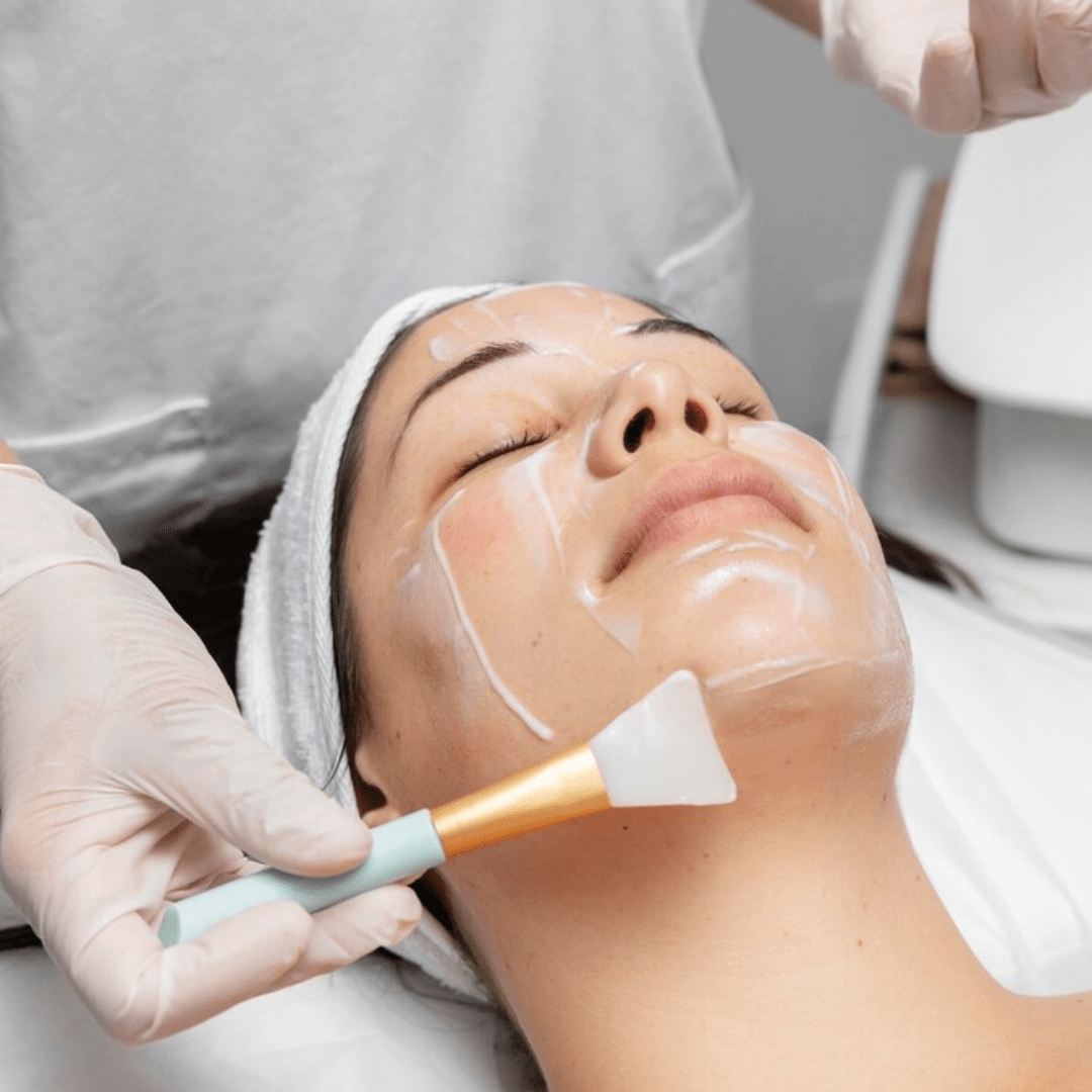 chemical peel