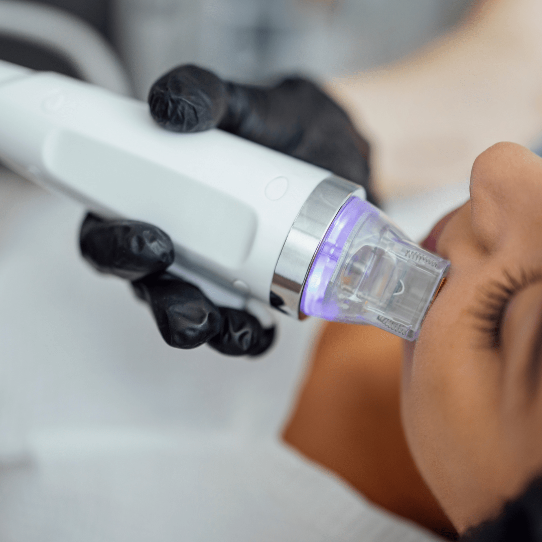 microneedling philippines