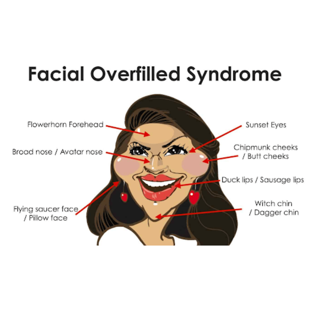 overfilled syndrome