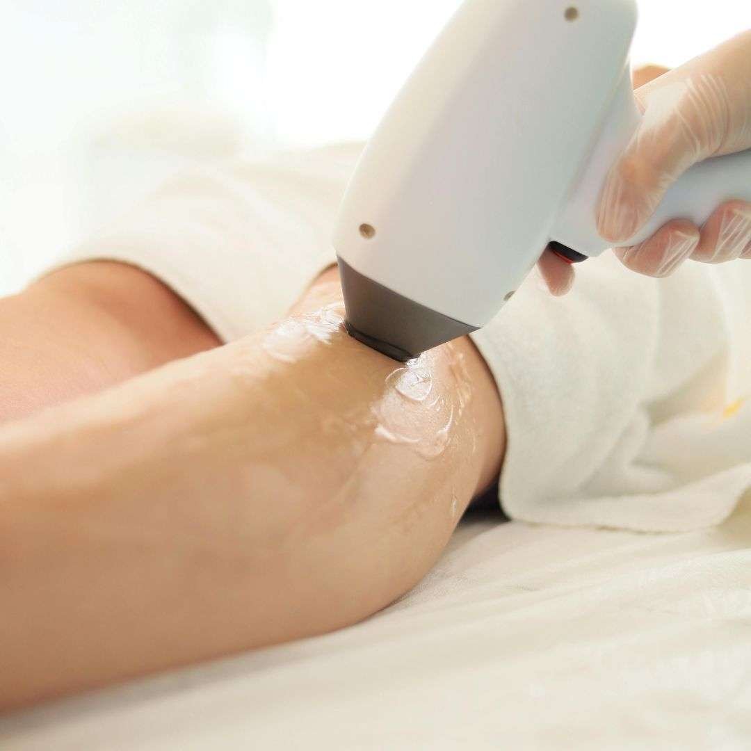 Q-Switch Laser Long Pulse ND